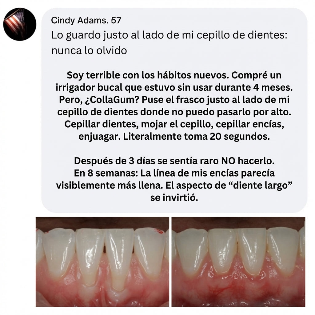 CollaGum™- Encías Más Firmes Sin Cirugia