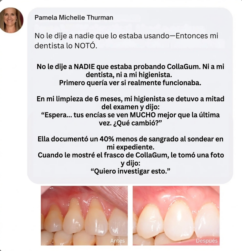 CollaGum™- Encías Más Firmes Sin Cirugia